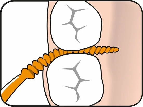 TePe EasyPick XS-S Oranje 36 Stuks 12 TePe EasyPick XS-S Oranje 36 Stuks - Afbeelding 12