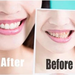 Fenom Royal Tanden Bleken Strips - 14 Stuks - Bamboe - Houtskool - Mondzorg - Zonder Peroxide - Hygi?ne -Oral B SHOP 550x458 13