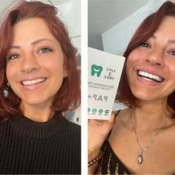 Love2smile PAP+ Premium Strips - Whitening Strips - De Natuurlijke Tandenbleker Van Nederland & Belgi? - Goedgekeurde Tandenbleek Strips - Teeth Whitening Strips - Wittere Tanden - Zonder Peroxide -Oral B SHOP 550x469 1