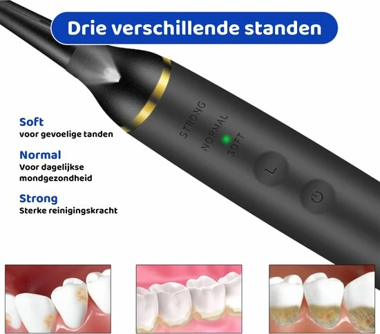 ExCorn Elektrische Tandsteen Verwijderaar - Elektrisch Tandplak Verwijderen - Inclusief Tandartssetje - Tanden Polijsten 6 ExCorn Elektrische Tandsteen Verwijderaar - Elektrisch Tandplak Verwijderen - Inclusief Tandartssetje - Tanden Polijsten - Afbeelding 6