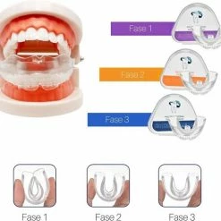 Edoir Rechte Tanden Beugel - Retainer Voor Rechte Tanden - Rechte Tanden Bitje -Oral B SHOP 550x510 8