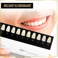 The Million Dollar Smile? Luxe Tandenbleekset - Zonder Peroxide (0%) - Wittere Tanden - 100% Natuurlijk - Tanden Bleken - Tandenblekers - Teeth Whitening Kit - Geen Gevoelige Tanden - Black Friday 2022 -Oral B SHOP 550x535 1