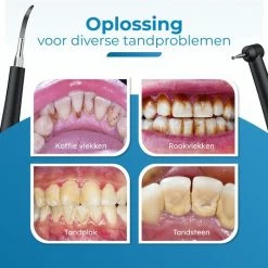 V-Goods Professionele Tandsteen Verwijderaar - 5 Standen - Inclusief Tandarts Set - Met 3 Opzetstukken - Elektrisch - Tandplak -Oral B SHOP 550x535