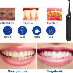 ExCorn Elektrische Tandsteen Verwijderaar - Elektrisch Tandplak Verwijderen - Inclusief Tandartssetje - Tanden Polijsten 13 ExCorn Elektrische Tandsteen Verwijderaar - Elektrisch Tandplak Verwijderen - Inclusief Tandartssetje - Tanden Polijsten -Oral B SHOP 550x537 4