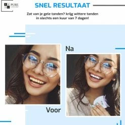 Pure Luxure Teeth Whitening Kit - Zonder Peroxide - Met Handleiding En Ebook - Tandenbleekset - LED Tanden Bleken - Inclusief Whitening Strips - 100% Natuurlijk & Peroxidevrij - Black Friday 2022 -Oral B SHOP 550x538 2