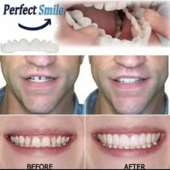 V-Goods Kunstgebit - Facings - Witte Tanden - Kunst Tanden 7 V-Goods Kunstgebit - Facings - Witte Tanden - Kunst Tanden -Oral B SHOP 550x547 12