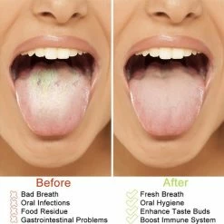 RVS Tongschraper Set Voor Mondverzorging ? Vardaan ? 4 In 1 Set ? Tongreiniger & Tongborstel ? Duurzaam & Herbruikbaar ? Tong Hygi?ne ? Mondhygi?ne - Tongreiniger ? ? ? -Oral B SHOP 550x547 19