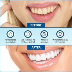 V-Goods Premium Whitening Strips - Tandenbleek Strips - Wittere Tanden - 28x Tandenbleek Strips DIRECT Resultaat - Tandenbleekset - Whitening - Tandenblekers -Oral B SHOP 550x549 111