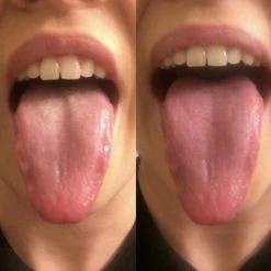 Dentek Orabrush Tongreiniger -Oral B SHOP 550x549 53