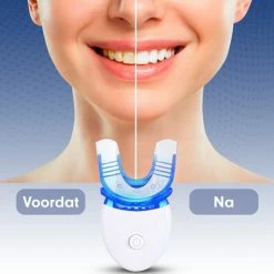 Imperatoris Diamond White | Tandenbleekset? Inclusief Teeth Whitening Strips - Tandenbleek Strips ? 3D LED ? Wittere Tanden 17 Imperatoris Diamond White | Tandenbleekset? Inclusief Teeth Whitening Strips - Tandenbleek Strips ? 3D LED ? Wittere Tanden -Oral B SHOP 550x550 1121