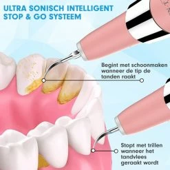 DEN-T? PRO U500 - Elektrische Sonische Tandsteen Verwijderaar - Roze -Oral B SHOP 550x550 1178