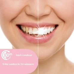 At-shop 28 Strips - 14 Behandelingen | Witte Tanden 30 Minuten |Tanden Bleken – Teeth Whitening - Tandenbleekset | Tanden Bleker- Professionele Tandenbleek Strips Teeth Whitening Strips - Wittere Tanden - Zonder Peroxide - Tanden Bleken -Oral B SHOP 550x550 1255
