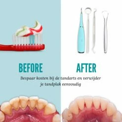 Shiney Tandsteen Verwijderaar - Tandplak Verwijderaar - Tanden Polijsten - Inclusief Tandarts Set - Tongschraper - Tandartshaakje - Elektrisch - 4 Delig - 5 Standen - Sonisch -Oral B SHOP 550x550 1508