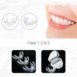 Edoir Rechte Tanden Beugel - Retainer Voor Rechte Tanden - Rechte Tanden Bitje -Oral B SHOP 550x550 1563