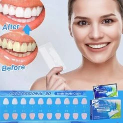 Merkloos Tanden Bleken - Witte Tanden - 5D White Teeth Whitening Strips - Teeth Whitening Strips - 28x Tandenbleek Strips - Zonder Peroxide (0%) -Oral B SHOP 550x550 1567