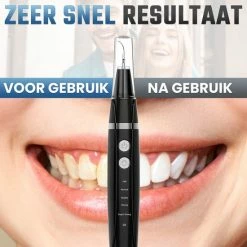 RVBS? Sonische Tandsteen Verwijderaar | Elektrische Tandsteen Verwijderaar | Complete Set | Inclusief 3 Verschillende Opzetstukken -Oral B SHOP 550x550 1578