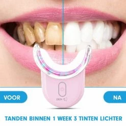 DEN-T? U-shape PRO - Tandenbleekset - 32 LED - Zonder Peroxide - Tandenbleken - Teeth Whitening - Roze - -Oral B SHOP 550x550 1901