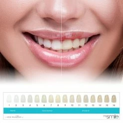 My Smile MySmile Tandenbleekset - Thuis Tanden Bleken - Met Natuurlijke Ingredi?nten 11 My Smile MySmile Tandenbleekset - Thuis Tanden Bleken - Met Natuurlijke Ingredi?nten -Oral B SHOP 550x550 270