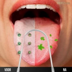 SolidStock Professionele Tongschraper Voor Mondverzorging - 4 Delige Tongreiniger - Ayurveda - RVS -Oral B SHOP 550x550 300