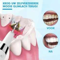 DEN-T? PRO U500 - Elektrische Sonische Tandsteen Verwijderaar - Wit -Oral B SHOP 550x550 369