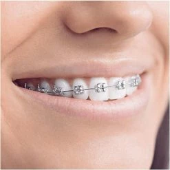 Oral B Oral-B Smartseries Teen - Elektrische Tandenborstel - Wit -Oral B SHOP 550x550 398