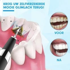 DEN-T® PRO U500 - Elektrische Sonische Tandsteen Verwijderaar - Zwart -Oral B SHOP 550x550 435