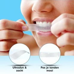 Imperatoris Diamond White - Teeth Whitening Strips - 28x Strips - Zonder Peroxide (0%) - Tandenbleekset – Mint -Oral B SHOP 550x550 493
