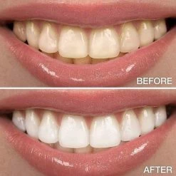 Perfect Wit - Whitening Pen - Tandenblekers - 100% Natuurlijke Ingredi?nten - Peroxidevrij - Veilig Bleken - Witte Tanden - Tandbleekset - Tanden Bleken - Whitening - Teeth Whitening - Frisse Adem 15 Perfect Wit - Whitening Pen - Tandenblekers - 100% Natuurlijke Ingredi?nten - Peroxidevrij - Veilig Bleken - Witte Tanden - Tandbleekset - Tanden Bleken - Whitening - Teeth Whitening - Frisse Adem -Oral B SHOP 550x550 820