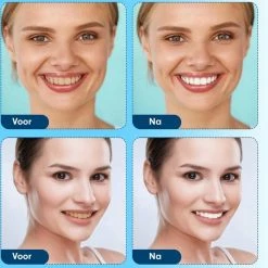 Imperatoris Diamond White - Teeth Whitening Strips - 28x Strips - Zonder Peroxide (0%) - Tandenbleekset – Mint -Oral B SHOP 550x556 5