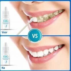 B-care Tanden Bleker ? Wittere Tanden ? Teeth Whitening Strips ? Professioneel Resultaat - Tandsteen Verwijderaar - Zonder Peroxide - Tandenbleekset - Tanden Bleken - Black Friday ? Sinterklaas ? Schoencadeautjes Sinterklaas -Oral B SHOP 550x560 1