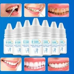 B-care Tanden Bleker ? Wittere Tanden ? Teeth Whitening Strips ? Professioneel Resultaat - Tandsteen Verwijderaar - Zonder Peroxide - Tandenbleekset - Tanden Bleken - Black Friday ? Sinterklaas ? Schoencadeautjes Sinterklaas -Oral B SHOP 550x579